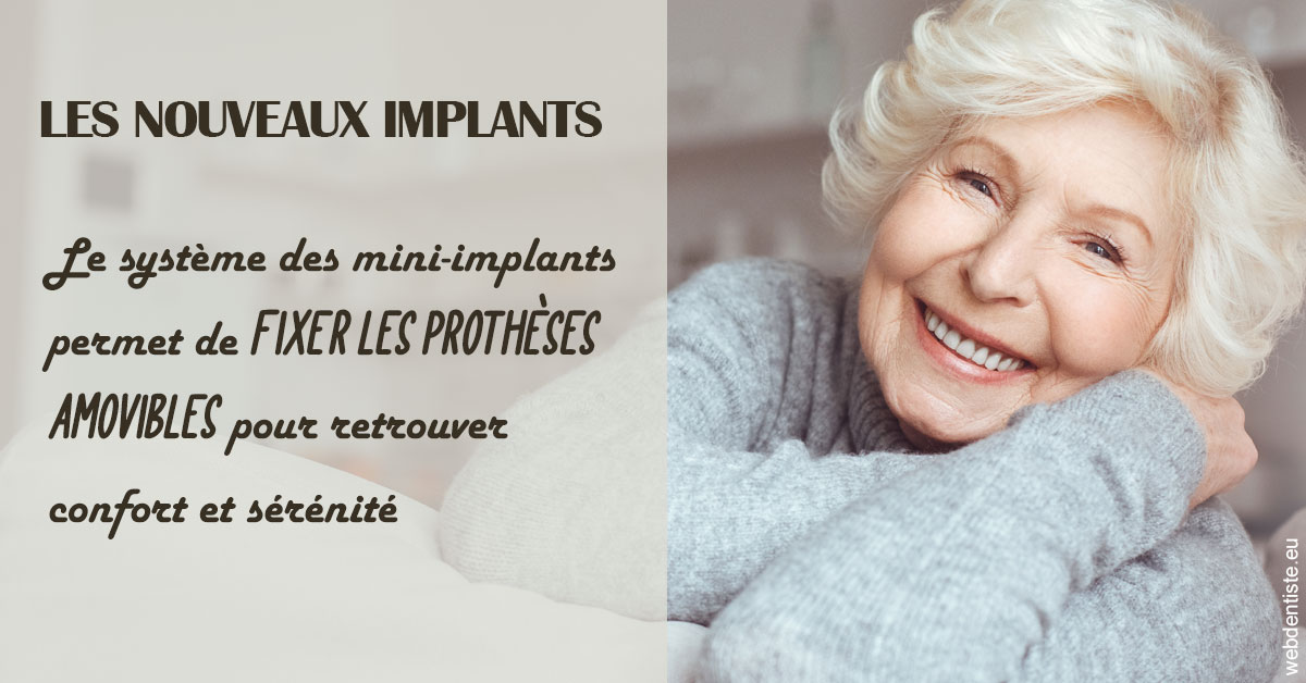 https://selarl-michelsolt.chirurgiens-dentistes.fr/Les nouveaux implants 1