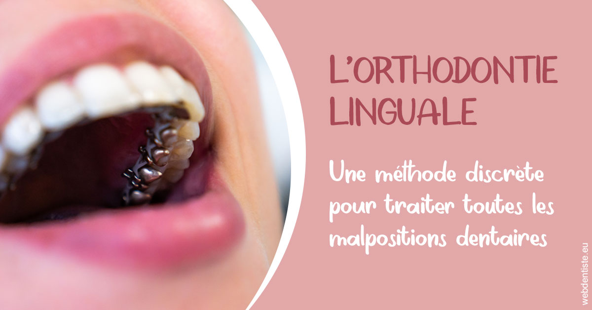 https://selarl-michelsolt.chirurgiens-dentistes.fr/L'orthodontie linguale 2