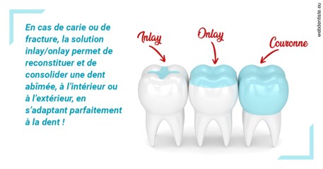 https://selarl-michelsolt.chirurgiens-dentistes.fr/L'INLAY ou l'ONLAY