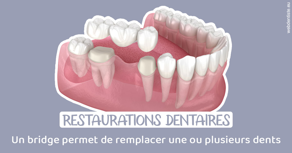 https://selarl-michelsolt.chirurgiens-dentistes.fr/Bridge remplacer dents 1