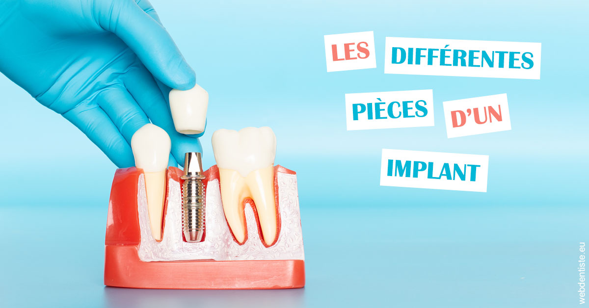 https://selarl-michelsolt.chirurgiens-dentistes.fr/Les différentes pièces d’un implant 2
