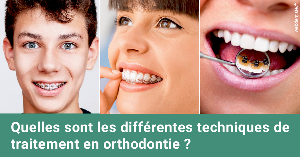https://selarl-michelsolt.chirurgiens-dentistes.fr/Les différentes techniques de traitement 2