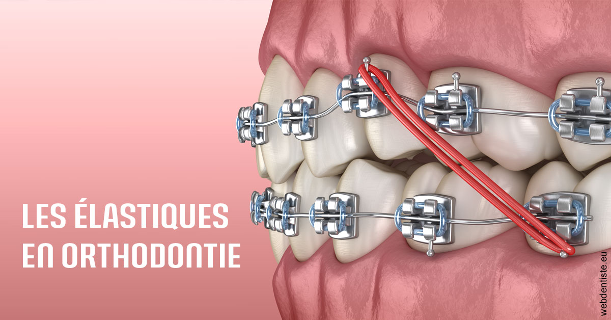 https://selarl-michelsolt.chirurgiens-dentistes.fr/Elastiques orthodontie 2