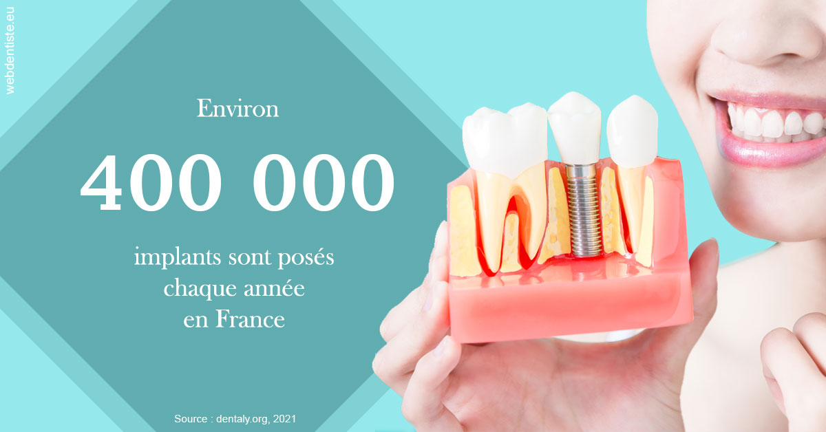 https://selarl-michelsolt.chirurgiens-dentistes.fr/Pose d'implants en France 2